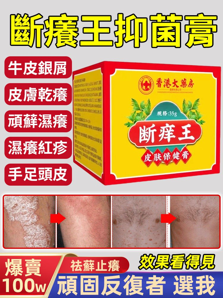 斷癢王抑菌膏,正品斷癢王抑菌膏,家中常備,大人小孩都能用,草本植物配方,溫和滋潤,止癢抑菌