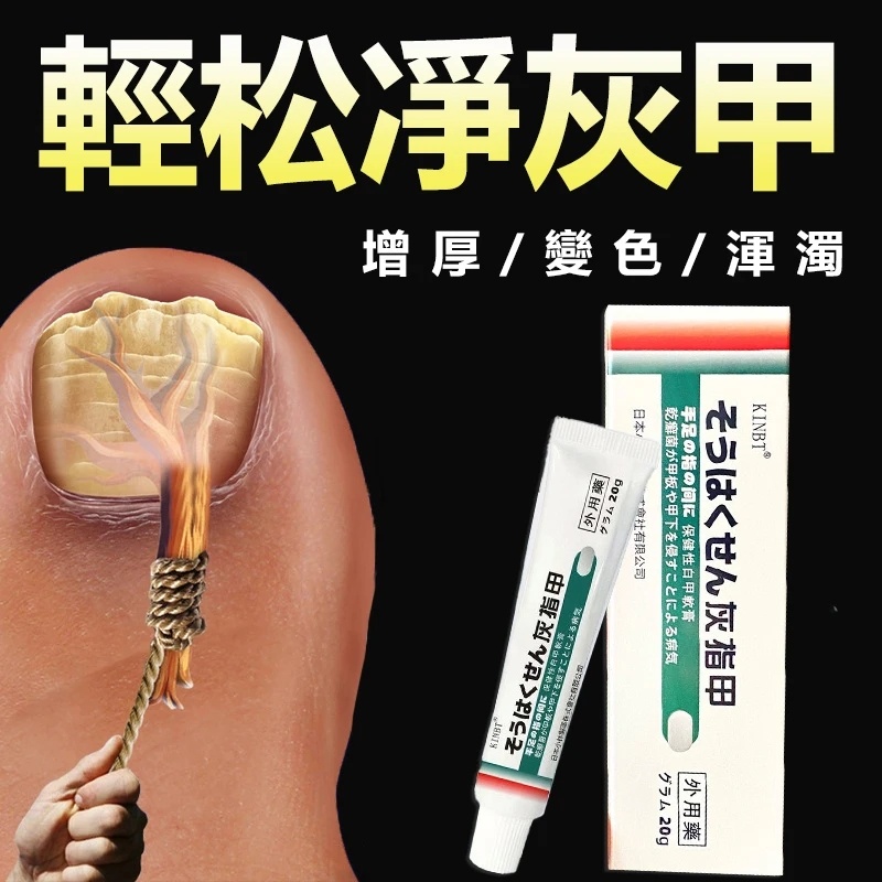 灰指甲的救星,🔥🔥灰甲抑菌膏!恢復指甲健康,有效解決灰指甲、甲溝炎問題,讓指甲7天重獲新生,就是這麼簡單。 灰指甲的救星,🔥🔥灰甲抑菌膏!恢復指甲健康,有效解決灰指甲、甲溝炎問題,讓指甲7天重獲新生,就是這麼簡單。