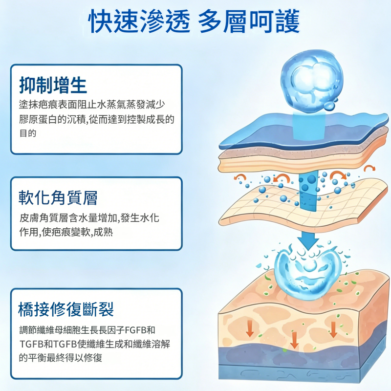 修正醫用矽酮祛疤膏,用於燒傷燙傷、手術疤痕、去除增生修復凝膠 修正醫用矽酮祛疤膏,用於燒傷燙傷、手術疤痕、去除增生修復凝膠