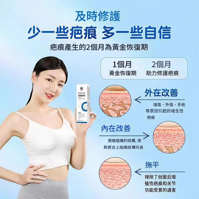 修正醫用矽酮祛疤膏,用於燒傷燙傷、手術疤痕、去除增生修復凝膠 修正醫用矽酮祛疤膏,用於燒傷燙傷、手術疤痕、去除增生修復凝膠