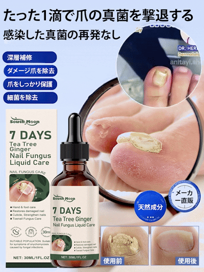 【食藥署認證 日本專業亮甲噴劑】✨日本醫師專業推薦 💅針對灰指甲（甲癬）與指甲增厚設計。噴劑能有效殺菌、從根源修護 💥徹底改善指甲變色、變脆、增厚、甲床分離與指甲異味｜二重ケア🇯🇵 深層滲透頑固甲板，喚醒指甲健康光澤 👌