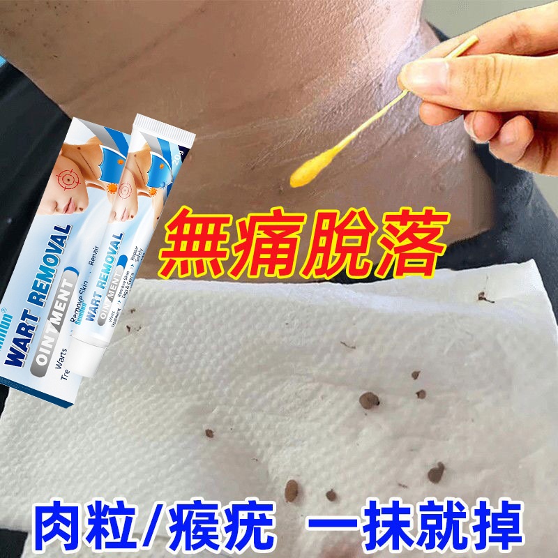 【專注皮膚問題!祛痣、袪老人斑、祛疣、祛肉刺、祛死皮、還你嬰兒粉嫩肌膚!一次祛除永不復發!】克疣膏 【專注皮膚問題!祛痣、袪老人斑、祛疣、祛肉刺、祛死皮、還你嬰兒粉嫩肌膚!一次祛除永不復發!】克疣膏